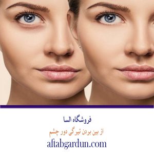 ضد تیرگی دور چشم | محصولات پوستی | السا